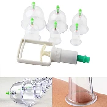 Hijama Cupping Therapy Set – 10 Piece